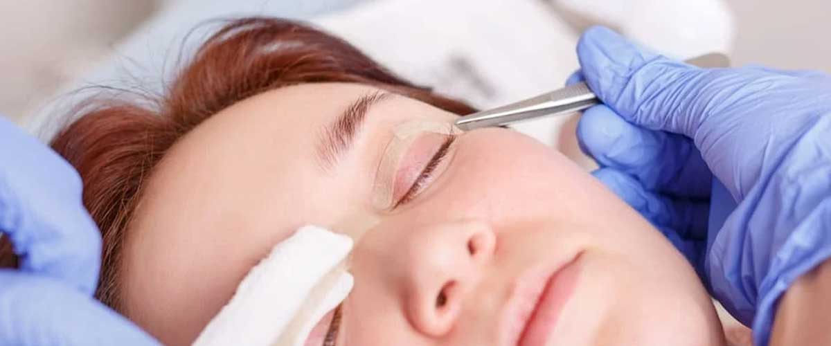 EyeLid Surgeries in Kandivali