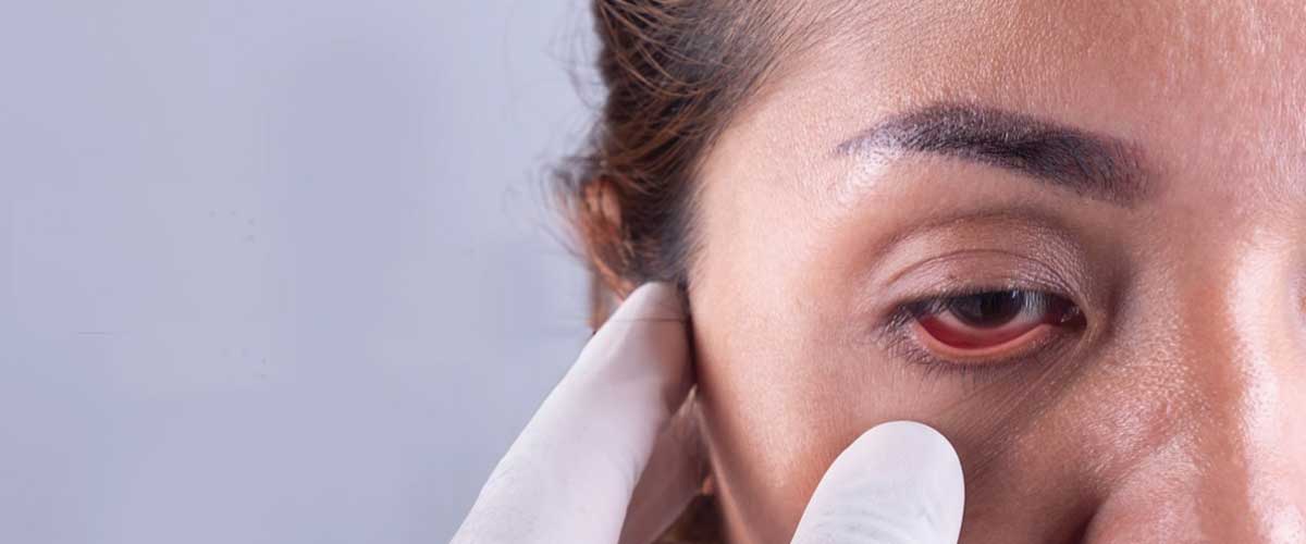 Glaucoma Treatment in Kandivali